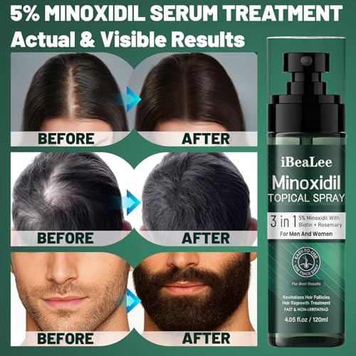 OURMUST Extra Strength 5% Minoxidil Hair Regrowth Spray Pack of 2 - 4.05 Fl Oz Each for Men & Women