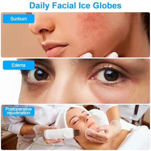 White 360 Rotating Stainless Steel Facial Ice Globes with Handles