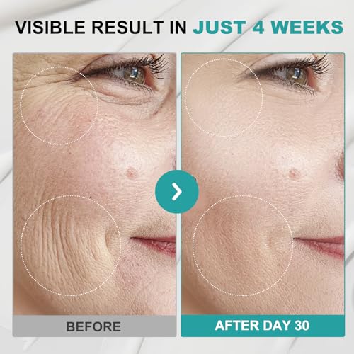 Instant Face Lift Cream - Face and Neck Firming and Tightening Cream with Collagen & Retinol, 6-in-1 Hydrating Neck Firming C-ream | Fast-Absorbing, Visibly Smoothing Lines