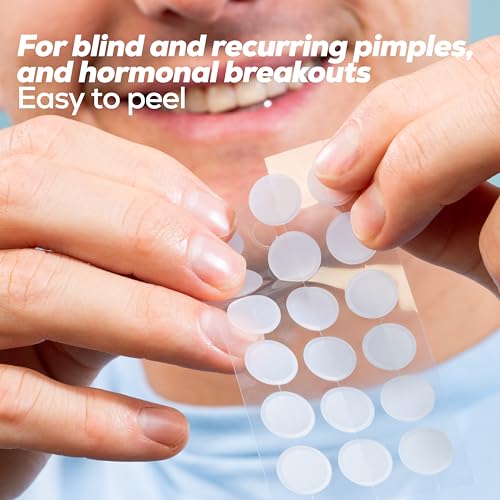 Hanhoo Extra Strength Blemish Patch Bundle, 216 Total Patches, Salicylic Acid Pimple Patches, Shrinks Stubborn Pimples, Conceals Zits, Absorbs Fluid, Invisible Pimple Patches, Korean Skincare