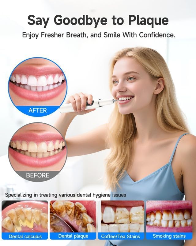 Plaque Remover for Teeth - Tartar & Stain Removal Device with 5 Modes