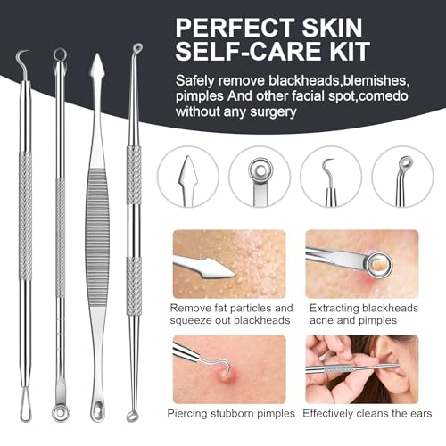 Silver Blackhead Remover Kit 11Pcs with Magnifying Glass & Alcohol Pads - Acne Extraction Tools
