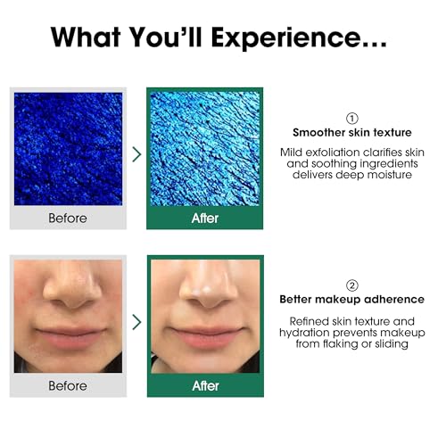 SOME BY MI AHA BHA PHA 30 Days Miracle Toner Pack of 2 for Blemish & Pore Care