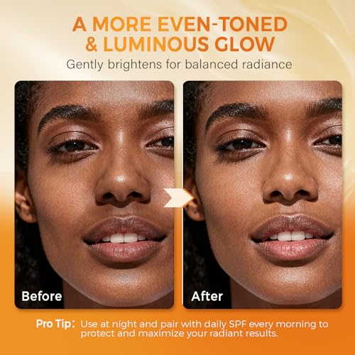 Turmeric Kojic Acid Soap for Dark Spots Brightening ? Face and Body Wash with Vitamin C, E, Shea Butter, Jojoba oil, Grape Seed Oil & Glycerin ? Soap for Women & Men (120g x 2)