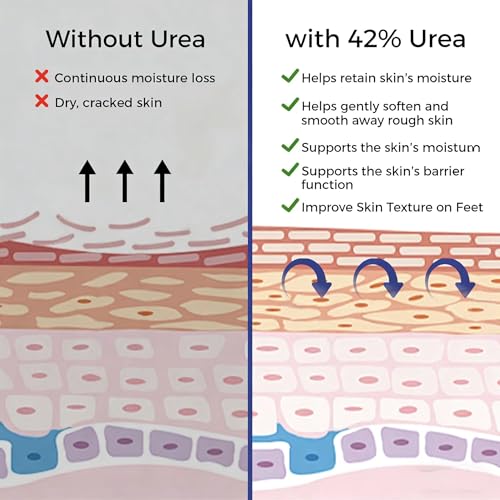 Urea Cream 42% with Salicylic Acid for Dry Rough Skin - 2 Bottles, 5.29 oz Each