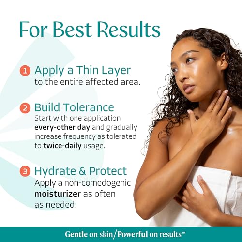Almond Clear Mandelic Acid Level 2 Serum - Body Acne & Dark Spot Remover 1 Fl Oz - Extra Strength