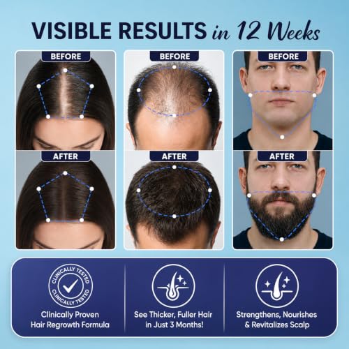 OLIVITA Minoxidil Hair Growth Spray for Men & Women 2.02oz Pack of 2