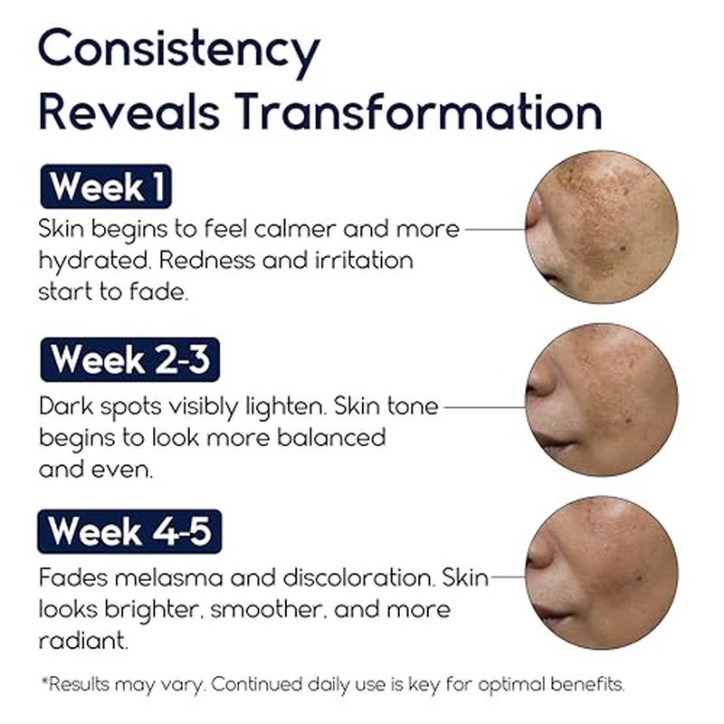 Meladerm Treatment for Face