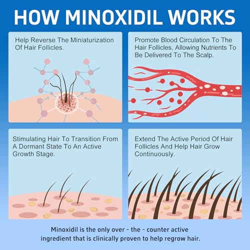 Minoxidil Hair and Beard Growth Treatment - 6 Pack, 5% with Biotin & Castor Oil, Support Thicker Fuller Hair & Beard, 12 fl oz