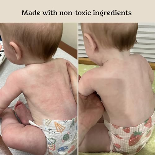 Baby Power Serum - Hydrating Probiotic Skincare for Infants & Kids, Non-Toxic, EWG Verified