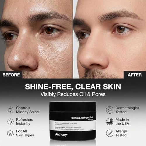 Anthony Witch Hazel Pore Cleansing Pads - 60 Count Pack of 1, Exfoliating Cotton Pads for Face & Blemish Control