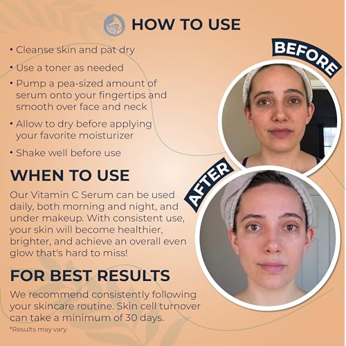 Vitamin C Face Serum - Dark Spot Corrector, Hydrating & Radiance Boost, Vegan & Sensitive Skin Friendly, 1oz - Stability & Botanical Hyaluronic