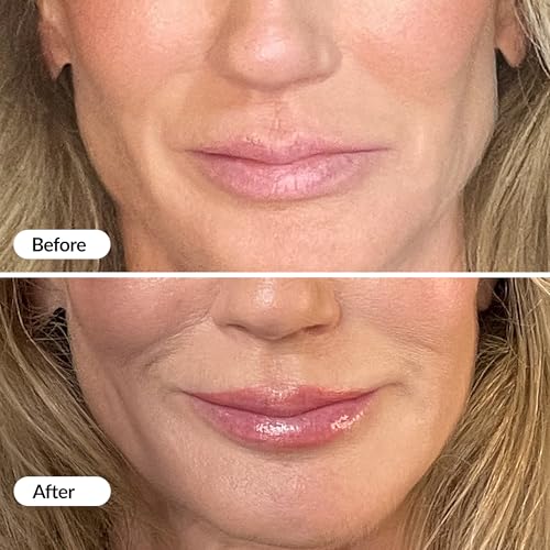 Lip Plumper and Hydrating Lip Serum - Instant & Long-Term Benefits