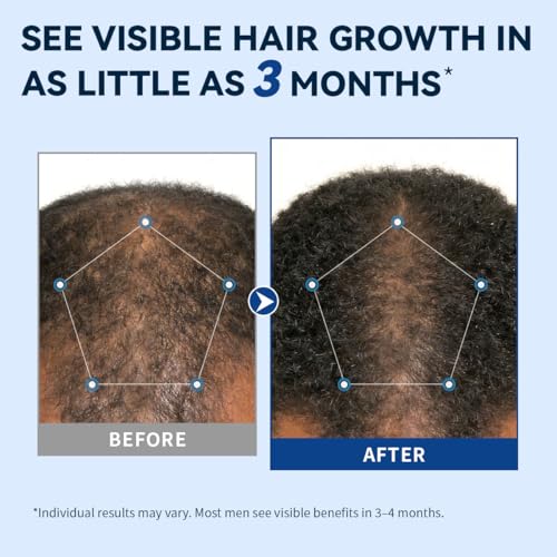 Men's Hair Regrowth Spray 5% Minoxidil Extra Strength Dual Pack 2oz