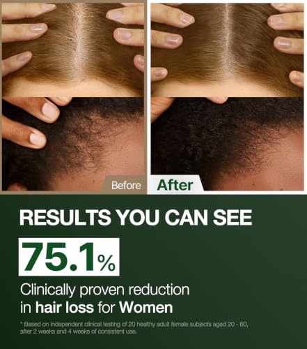 Vegan Hair Loss Shampoo for Women - Thinning & Postpartum Hair Care, 500ml