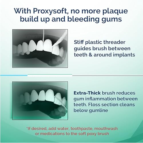 ProxySoft Periodontal Floss 5 Pack - Dental Floss for Braces & Gum Care