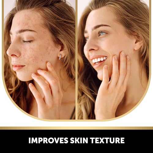VALITIC Kojic Acid Vitamin C & Retinol Soap Bars 5.19 Ounce Pack of 4 with Exfoliating Gloves