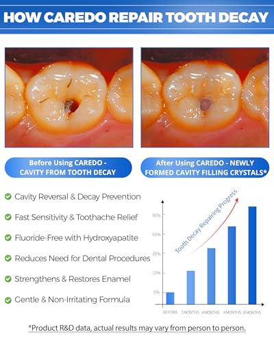 Fresh Mint Hydroxyapatite Cavity Repair Toothpaste 3.5oz - Remineralizing & Sensitivity Relief - Travel Size