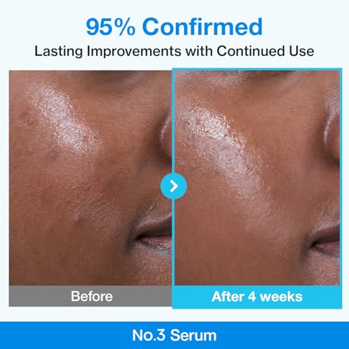 Retinol Pore-Refining Serum for Beginners - Niacinamide & Peptides, 30ml