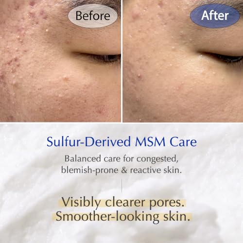 Deep Pore Face Wash with MSM Sulfur & Probiotics for Sensitive Skin