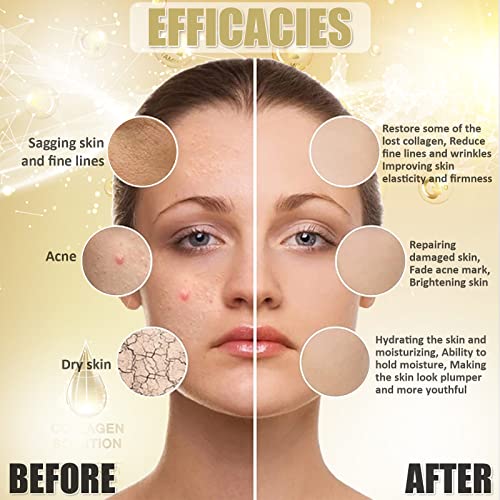 Collagen Jelly Face Mask Powder for Hydrating & Firming - 23 Fl Oz - Home Spa DIY Skincare - Variation: Collagen 1 Pack