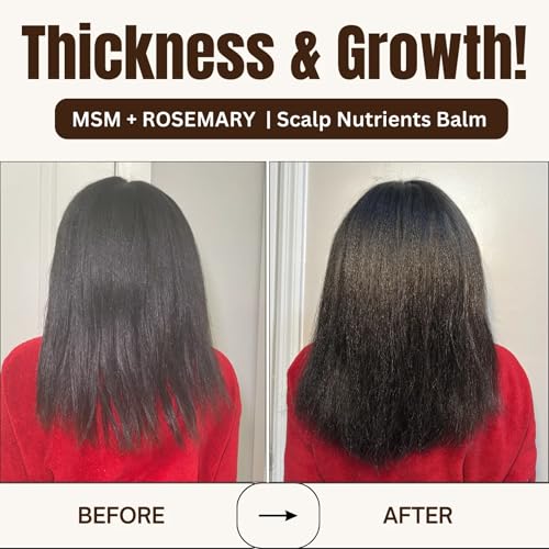 Qhemet MSM & Rosemary Hair Growth Balm for Dry Scalp & Thinning - Vegan, 4 oz
