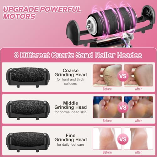 Spriak 16-in-1 Electric Callus Remover Foot File for Pedicure, Black