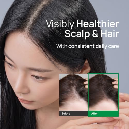 TEREZ & HONOR Double Pack Scalp Serum Roll-On for Hair Growth - 60 mL Korean Vegan Cooling Ampoule