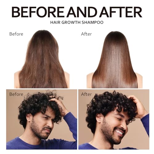 Biotin Rosemary Shampoo for Hair Growth & Strengthening - 300ml