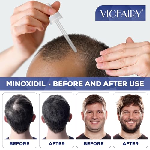 Minoxidil 5% Hair Growth Serum for Men and Women - 2 Bottles - Thicker, Fuller Hair Regrowth Treatment
