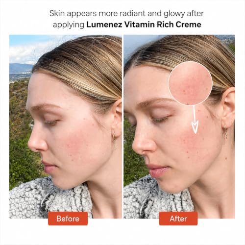 Vitamin C & E Face Moisturizer for Dry Skin - 50ml Hydrating & Brightening Cream