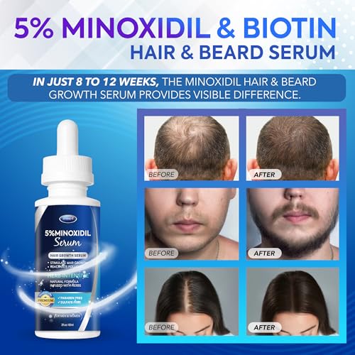 DABIDA 5% Minoxidil Hair Growth Serum for Men & Women - 4 Pack, 2 Fl Oz Each
