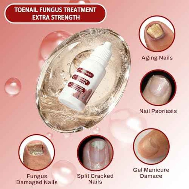 Fungi Nail Toenail Treatment Extra Strength,Toenail Renewal Serum, Nail Conditioning Solution for Thick&Discolored Nails, Quick-Dry Dropper, Safely & Gently for Healthier Nails,