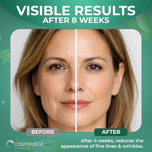 Retinol Face Serum with Hyaluronic Acid & Vitamin E - Anti-Aging, Hydrating, 1oz