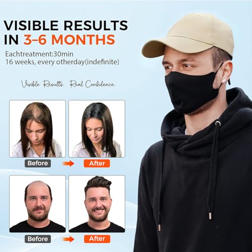 Red Light Hair Growth Cap - Hair Growth Cap for Men Women - Lasers & LED Light Therapy Cap - FDA Cleared Rechargeable Hair Loss Treatment Device for Fast Thickening - Ideal for Home Use