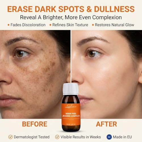 Miami Jessner Complex Chemical Peel for Face Exfoliating Facial Peel with Salicylic, Lactic & Kojic Blend - Skin Peel for Dark Spots Uneven Tone & Dullness - Professional Peeling 1.7 fl oz