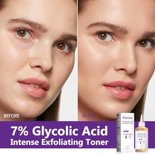 7% Glycolic Acid Exfoliating Toner, Exfoliating Skin Care Facial Toner, Improves Texture, Reduces Breakouts Pores and Fine Lines, Suitable for All Skin Types