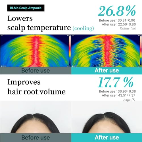 Hair Growth Serum Roll-On for Thinning Hair & Scalp Health - Clinically Proven, DHT Balance Support, Korean Formula, 0.5 fl oz