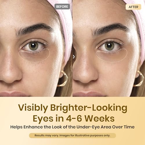 Beetles Caffeine Eye Cream with Retinol, Blur & Glow Under Eye Cream for Dark Circles & Puffiness, Help Improve the Look of Fine Lines, Brighten Eyes Care with Cooling Metal Tip, 0.68 fl oz (20 ml)