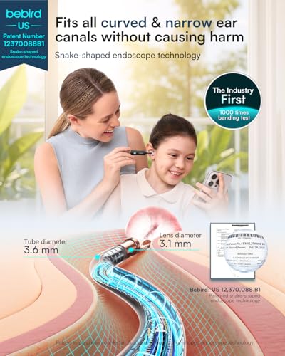 Ear Wax Removal Kit with 2K HD Camera & Visual Tweezers - Starlight Black