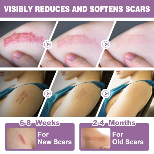 Silicone Scar Sheets 2 Rolls, Silicone Scar Tape (1.6¡± x 120¡± Roll-3M) Pro-Grade Silicone Scar Removal Strips, Reusable, Scar Tape for Wrinkles, Tummy Tuck, C-Section, Keloid, Burn, Acne Scars