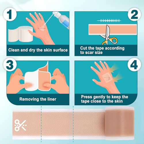 Arme Silicone Scar Tape, Silicone Scar Sheets for Surgical Scars(1.6"x180" Roll-4.6M), Medical Grade Scar Tape Reusable Sheets for Scar Treatment, Soft Scars Tapes for C-Section Keloid Tummy Tuck