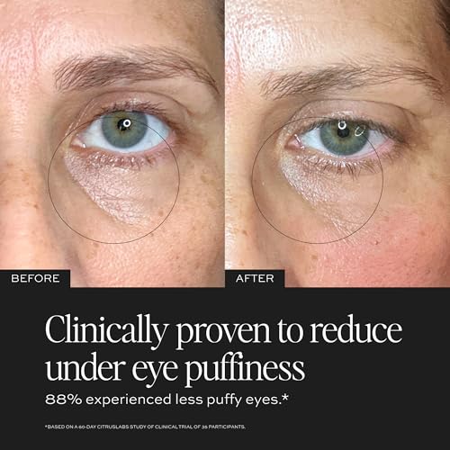 Luminosity Eye Serum with Caffeine and Peptides for Dark Circles & Puffiness - 0.5 oz