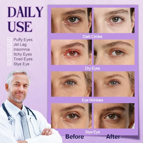 Steam Eye Mask, Heated Eye Mask For Sleep & Dry Eye Relief, Stye Eye Treatment, Warm Compress, Spa, Travel Essentials & Relaxation Disposable Eye Mask, Lavender 18 Pack