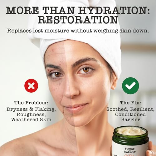 Forge & Harbor Grass-Fed Whipped Tallow & Honey Balm ? Deep Moisture Face & Body Cream with Manuka Honey, Vitamin E, Rosehip | For Rosacea, Eczema, Dry, Wrinkles & Sensitive Skin (4oz)