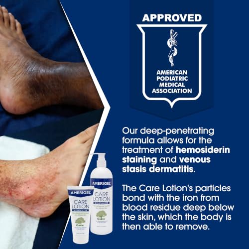 Amerigel Care Lotion 6 oz - Hypoallergenic Moisturizer for Diabetic & Sensitive Skin