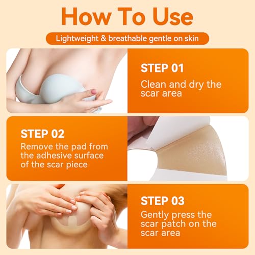 Silicone Scar Sheets for Breast - 6 Pack, Anchor Design for Precise Fit, Medical Grade & Reusable Breast Silicone Scar Tape for Surgical Scars (Yellow)