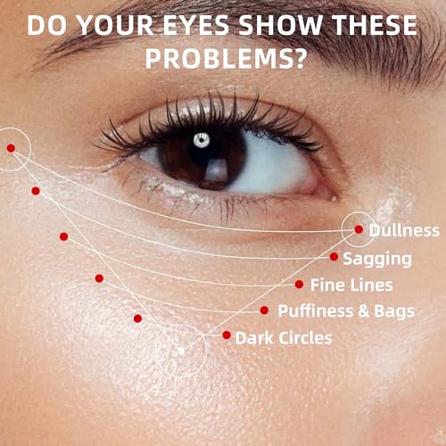 Retinol Eye Cream for Dark Circles and Puffiness, Hydrating Under Eye Cream for Dark Circles, Anti Aging Dark Circle Eye Cream for Fine Lines, Wrinkles, Firming Eye Contour, 1.06 oz