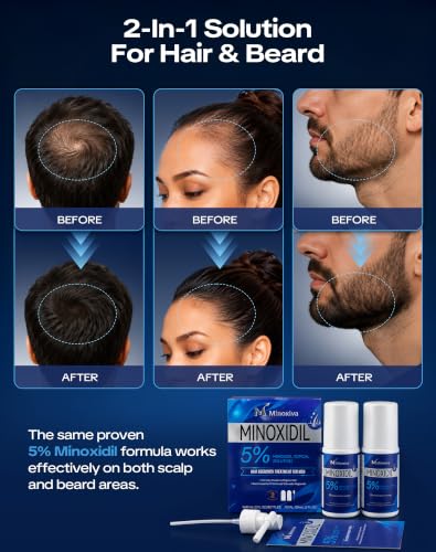 Minoxidil 5% Hair Growth Solution with Spray Nozzle for Men and Women - Thinning Hair & Beard Treatment, 2-Month Supply