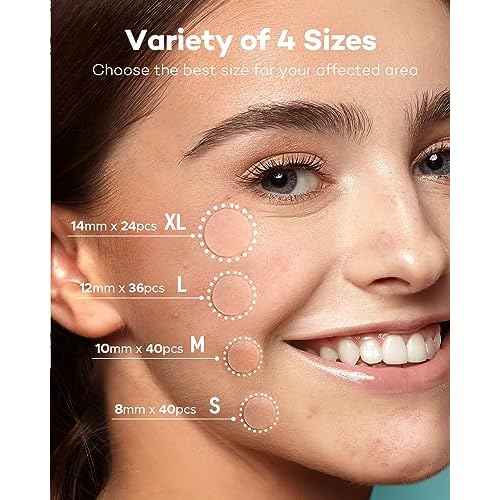 TKTK Pimple Patch Acne Patch, 4 Sizes 140 Patches Acne Absorbing Cover Patch, Hydrocolloid Invisible Acne Patches for Face Zit Patch Acne Dots Tea Tree, Calendula Oil